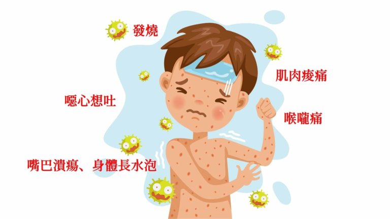 小孩發燒是感染腸病毒嗎？